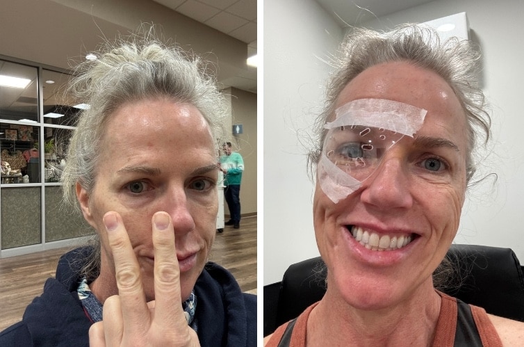 November 2025 - My Eyes 4 cataract surgery 2